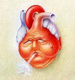 ChronicHeartFailure.jpg image by mrsghose